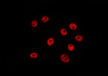 Polyclonal Rabbit anti-Human SATB2 Antibody (IHC, IF, WB)