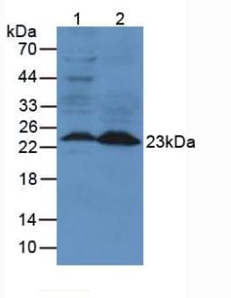 LCN2 / Lipocalin 2 / NGAL Antibody (aa21-200, PE)