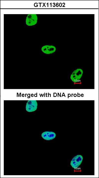 Polyclonal Rabbit anti-Human SAE1 Antibody (aa3-247, IHC, WB)