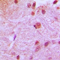CBFA1 / RUNX2 Antibody (Internal)