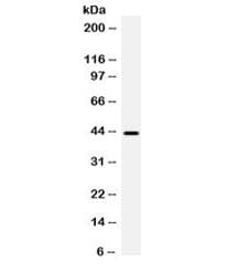 BMP6 Antibody