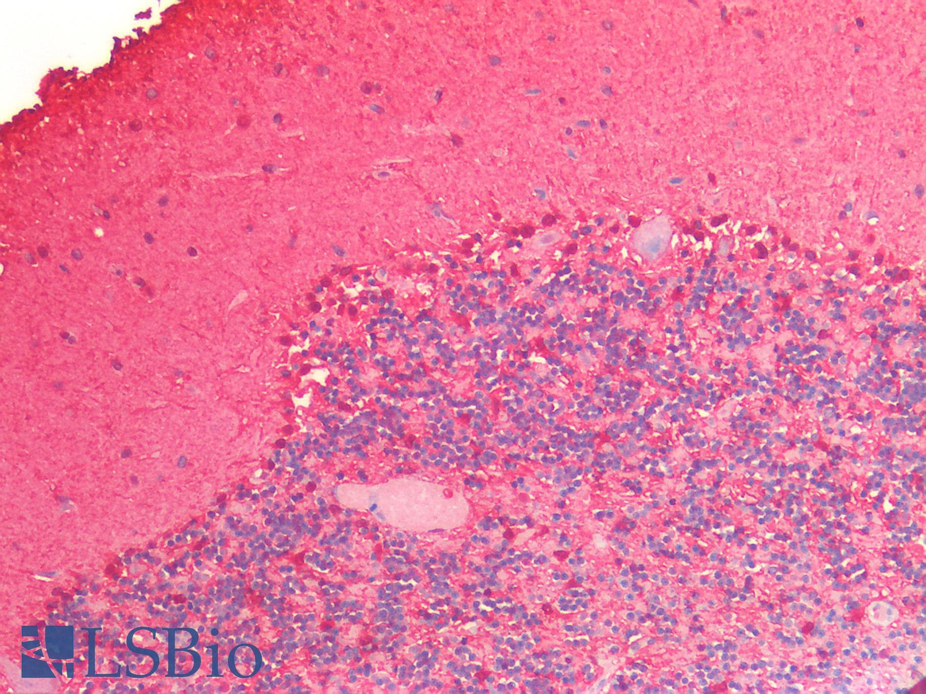 PathPlus™ ENO1 / Alpha Enolase Antibody