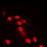 IHC-plus™ SYNE3 / C14orf49 Antibody (Internal)