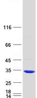 Human GSTO2 Protein (Recombinant Myc-DDK (Flag))