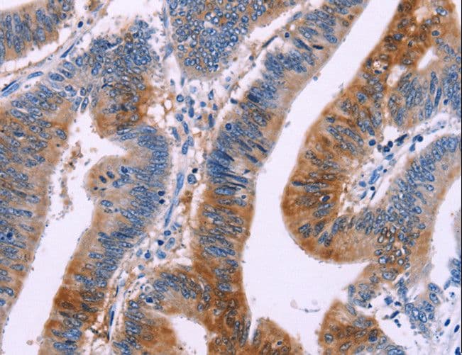 Polyclonal Rabbit anti-Human DUSP13 Antibody (IHC)