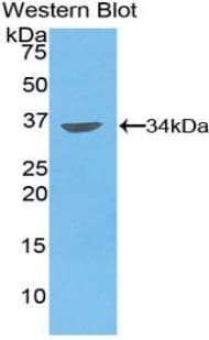 MMP7 / Matrilysin Antibody (aa1-267)