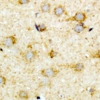 ACOX1 / ACOX Antibody