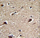 Polyclonal Rabbit anti-Human PGLS / 6PGL Antibody (aa191-220, IHC, WB)