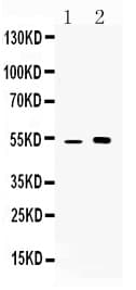 Yo / CDR2 Antibody