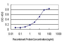 PLAU / Urokinase / uPA Antibody (clone 3B8)