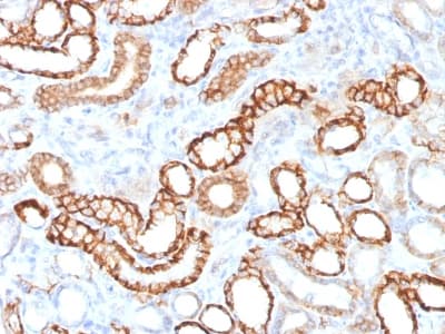 CDH16 / Cadherin 16 Antibody (clone CDH16/1532R, Azide-free, Carrier-free)