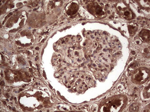 Monoclonal Mouse anti-Human LGALS3 / Galectin 3 Antibody (clone OTI2F1, Carrier-free, IHC, WB)