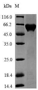 Agrobacterium 3-phosphoshikimate 1-carboxyvinyltransferase Protein (Recombinant 6His-SUMO, N-terminus)