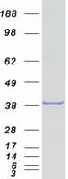 Human PAX9 Protein (Recombinant Myc-DDK (Flag))