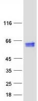 Human CALR / Calreticulin Protein (Recombinant Myc-DDK (Flag))
