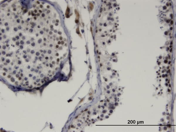 LMX1B Antibody (clone 1D12)
