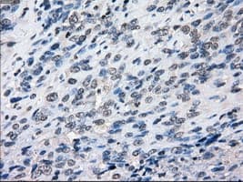 Monoclonal Mouse anti-Human BUB1B / BubR1 Antibody (clone OTI6E5, IHC, IF, WB)