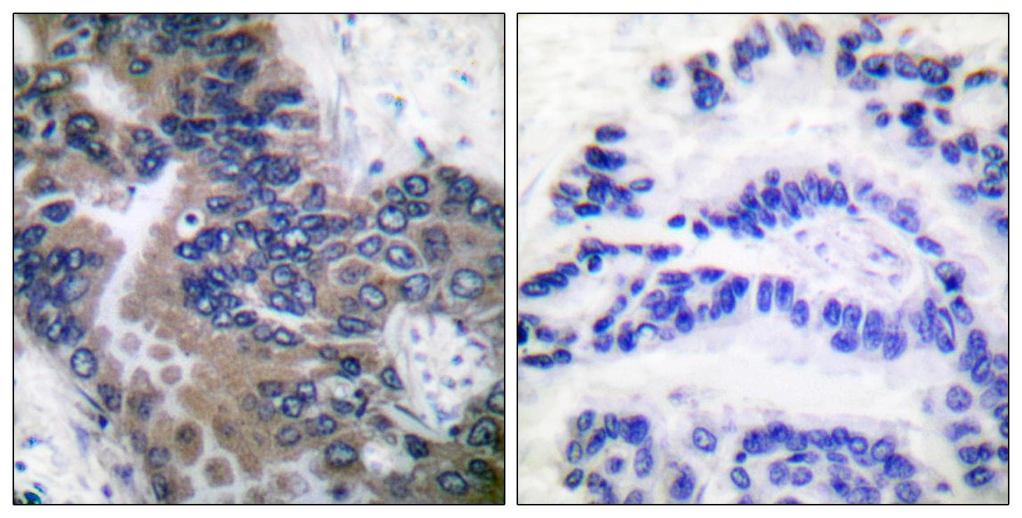 Polyclonal Rabbit anti-Human APIP Antibody (IHC, WB)