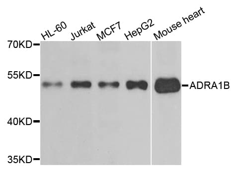 ADRA1B / Adrenoceptor alpha 1B Antibody