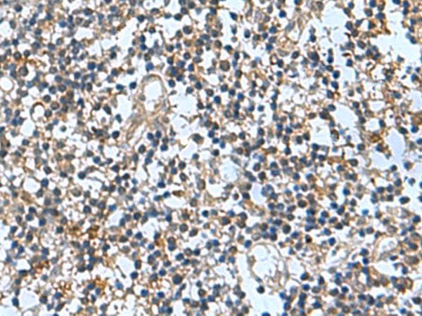 TRO / Trophonin Antibody