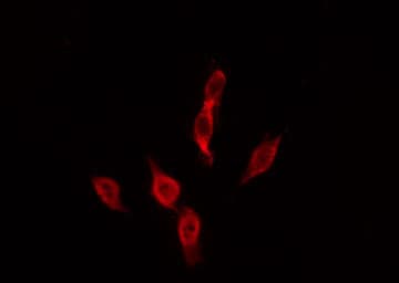 MC4R / Melanocortin 4 Receptor Antibody