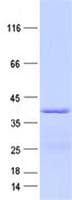 Human LIPJ Protein (Recombinant His, N-Terminal)