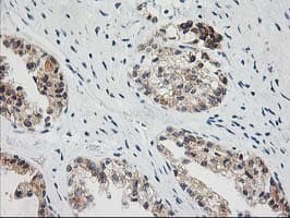 BAIAP2 / IRSP53 Antibody (clone OTI8G8)