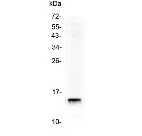 Polyclonal Rabbit anti-Human I-FABP / FABP2 Antibody (IHC, WB)