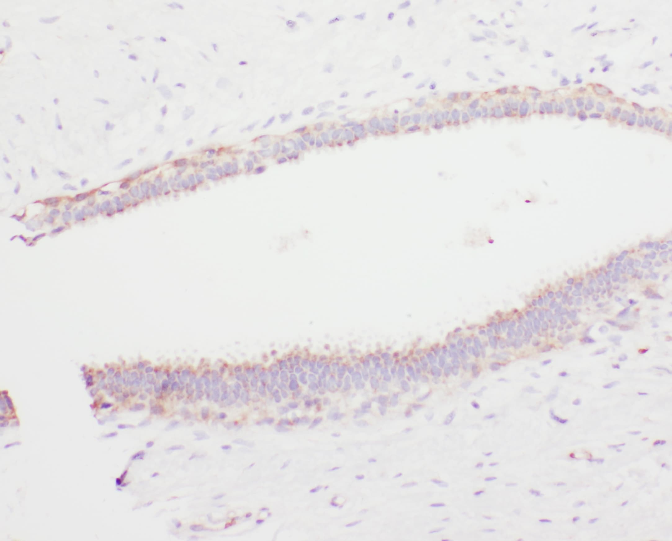 PLG / Plasmin / Plasminogen Antibody (aa103-352)