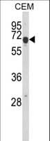 Polyclonal Rabbit anti-Human EDIL3 / DEL1 Antibody (aa337-365, IHC, WB)