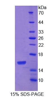 Mouse PDGF-CC Protein (Recombinant His-T7)