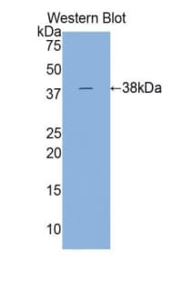 TNNT2 / CTNT Antibody (aa1-295, APC)