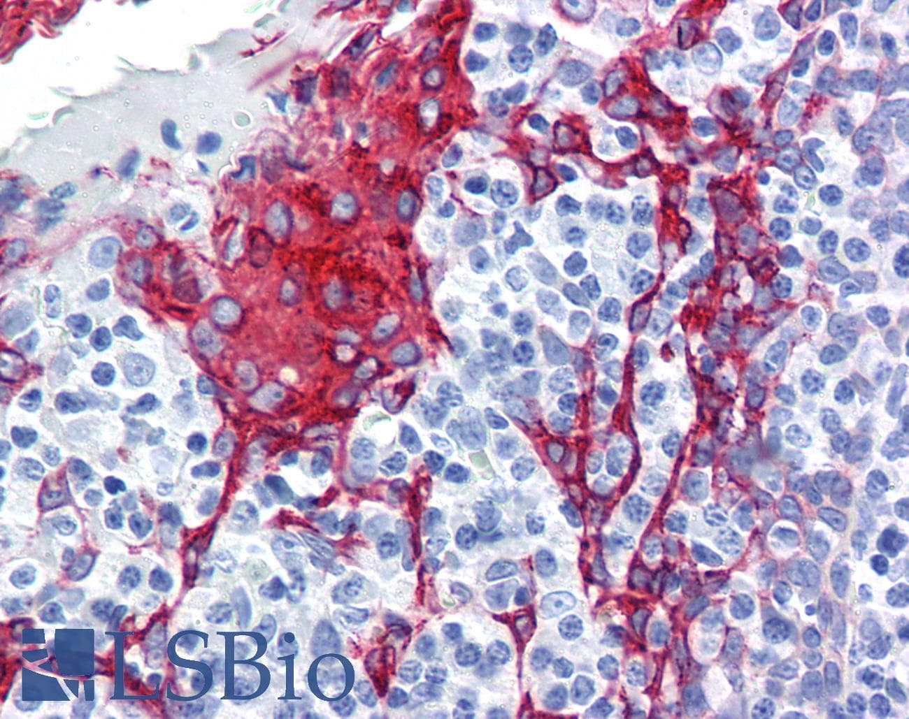 IHC-plus™ Monoclonal Mouse anti-Human KRT13 / CK13 / Cytokeratin 13 Antibody (clone AE8, IHC, WB)