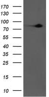 F13A1 / Factor XIIIa Antibody (clone 6F5, Carrier-free)