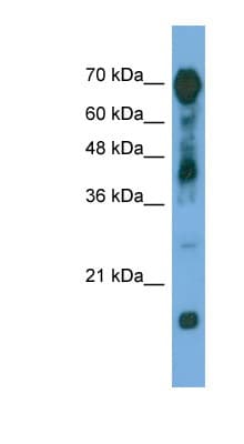 RAP1GAP Antibody (C-Terminus)