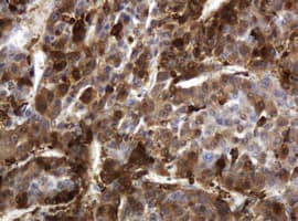 TP / Thymidine Phosphorylase Antibody (clone OTI1H7)