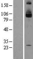 SKI Protein (Over-Expression Lysate Myc-DDK (Flag))