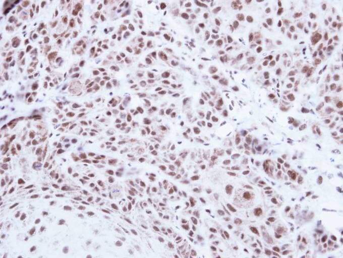 PRPF39 Antibody (aa146-415)