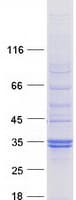 Human SPSB2 Protein (Recombinant Myc-DDK (Flag))