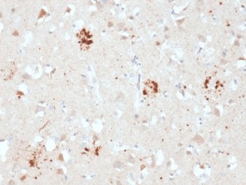 Monoclonal Mouse anti-Human Ubiquitin Antibody (clone UBB/2122, IHC)
