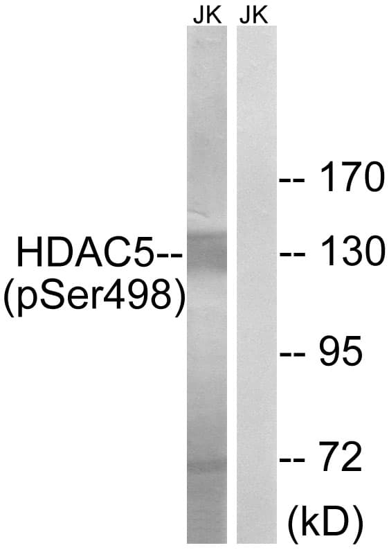 HDAC5 Antibody (phospho-Ser498)