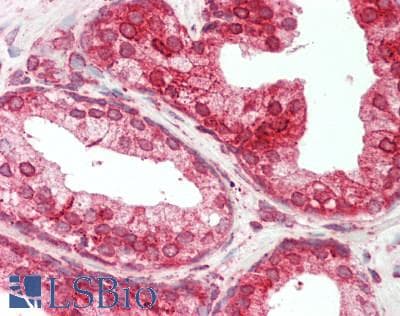 PathPlus™ CALR / Calreticulin Antibody (aa301-350)