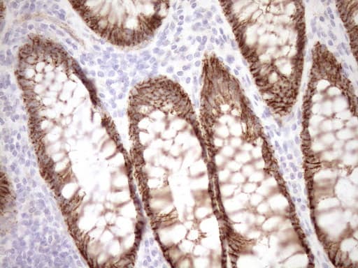 Monoclonal Mouse anti-Human EPLIN Antibody (clone OTI6F7, Carrier-free, aa1-275, IHC, WB)