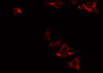 ME2 / Malate Dehydrogenase 2 Antibody