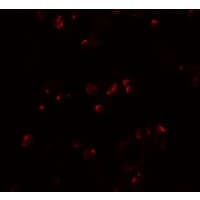 IL22 Antibody