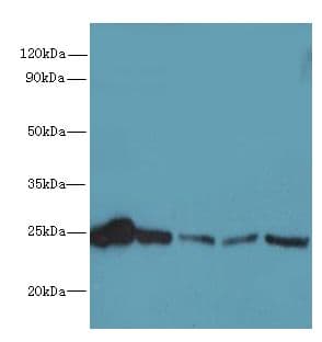 Polyclonal Rabbit anti-Human RAB6B Antibody (IHC, WB)