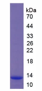Human COL2A1 / Collagen II Alpha 1 Protein (Recombinant His)