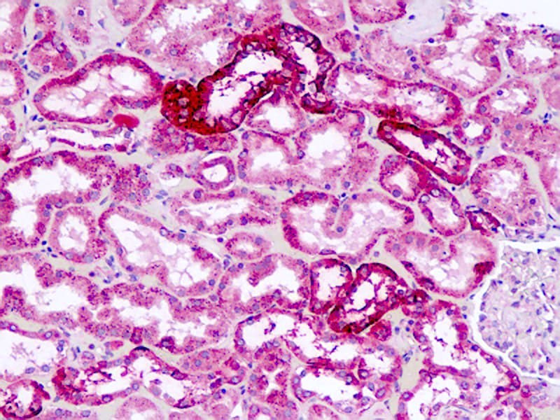 IHC-plus™ Polyclonal Rabbit anti-Human NPY1R Antibody (Extracellular Domain, IHC)