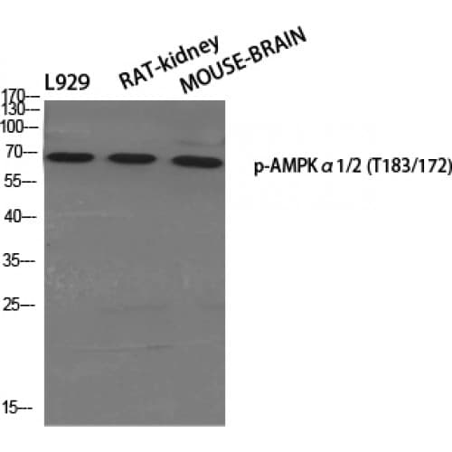 PRKAA1 + PRKAA2 Antibody (110-190 aa)