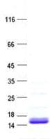 Human MRPL22 Protein (Recombinant His, N-Terminal)